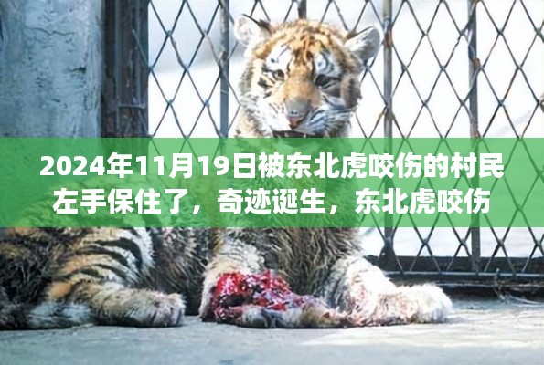 東北虎咬傷村民后奇跡誕生,左手成功保住