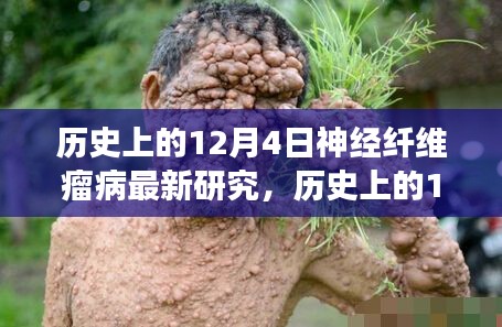 歷史上的神經(jīng)纖維瘤病研究之旅,與自然美景共舞,探尋內(nèi)心寧靜港灣的新突破