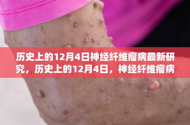 歷史上的神經纖維瘤病研究之旅,與自然美景共舞,探尋內心寧靜港灣的新突破