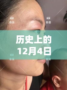 革命性雀斑最新技術誕生，重塑美顏新紀元，歷史上的十二月四日里程碑式突破