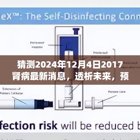 透析未來揭秘,腎病領域最新進展與動態分析預測至2024年展望(透析技術、新藥研發等)