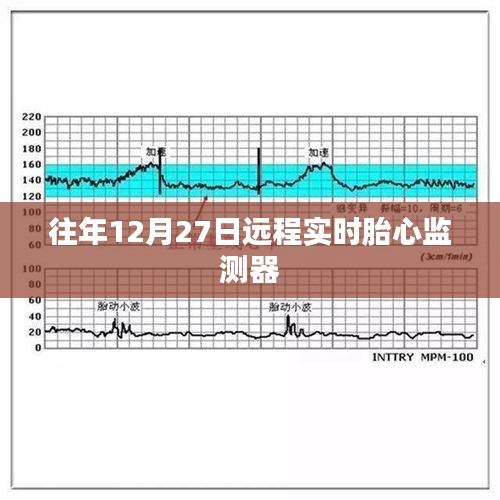 往年12月27日遠程胎心監測器介紹與使用指南