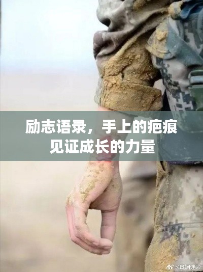 勵志語錄,手上的疤痕見證成長的力量