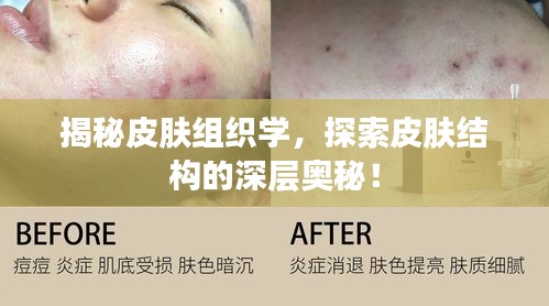 揭秘皮膚組織學，探索皮膚結構的深層奧秘！