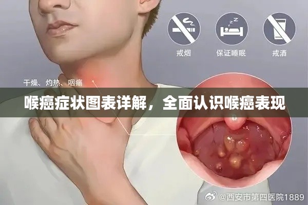 喉癌癥狀圖表詳解,全面認識喉癌表現