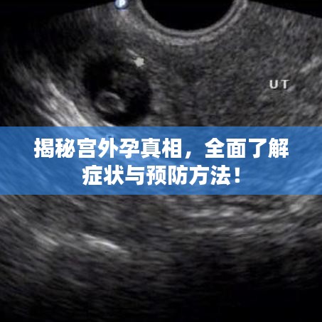 揭秘宮外孕真相,全面了解癥狀與預防方法!