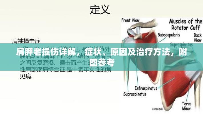 肩胛老損傷詳解，癥狀、原因及治療方法，附圖參考