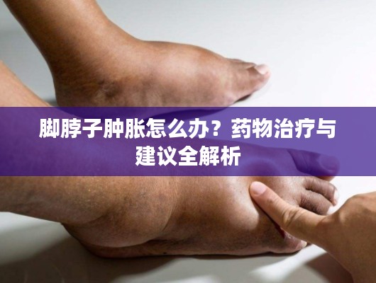 腳脖子腫脹怎么辦？藥物治療與建議全解析